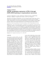 Original Article GOLM1 Upregulates Expression of PD-L1 Through EGFR/STAT3 Pathway in Hepatocellular Carcinoma