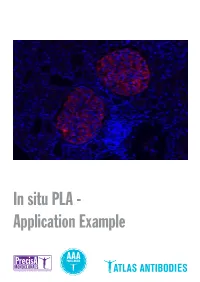 In Situ PLA - Application Example Detection of Protein-Protein Interactions by in Situ PLA with Precisa Monoclonals and Triple a Polyclonals