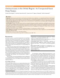 Onchocerciasis in the Orbital Region: an Unexpected Guest from Tropics