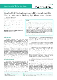 Rotator Cuff Tendon Ruptures and Degeneration As the First Manifestation of Polymyalgia Rheumatica Disease - a Case Report