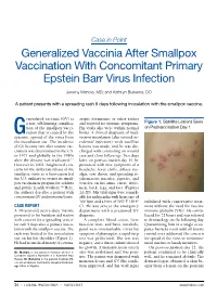 Generalized Vaccinia After Smallpox Vaccination with Concomitant Primary Epstein Barr Virus Infection