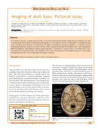 Imaging of Skull Base