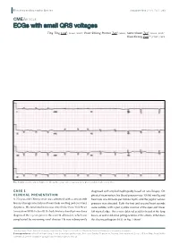 Ecgs with Small QRS Voltages