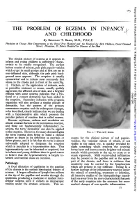 THE PROBLEM of ECZEMA in INFANCY and CHILDHOOD by REGINALD T