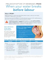 (PROM) – When Your Water Breaks Before Labour