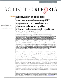 Observation of Optic Disc Neovascularization Using OCT