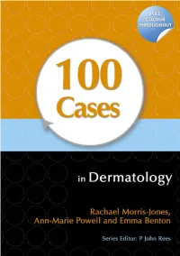100 CASES in Dermatology This Page Intentionally Left Blank 100 CASES in Dermatology