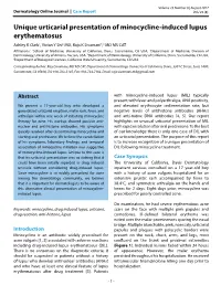 Unique Urticarial Presentation of Minocycline-Induced Lupus