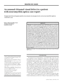 An Unusual Chiasmal Visual Defect in a Patient with Neuromyelitis Optica: Case Report