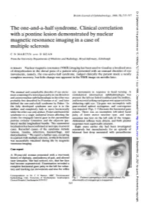 The One-And-A-Half Syndrome. Clinical Correlation with a Pontine Lesion Demonstrated by Nuclear Magnetic Resonance Imaging in a Case of Multiple Sclerosis