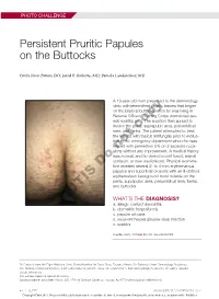 Persistent Pruritic Papules on the Buttocks