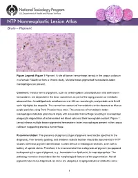 Brain – Pigment