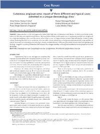 Cutaneous Angiosarcoma: Report of Three Different and Typical Cases Admitted in a Unique Dermatology Clinic*