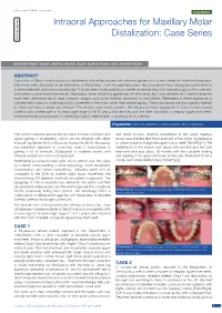 Intraoral Approaches for Maxillary Molar Distalization: Case Series Dentistry Section