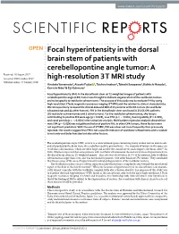 Focal Hyperintensity in the Dorsal Brain Stem of Patients With