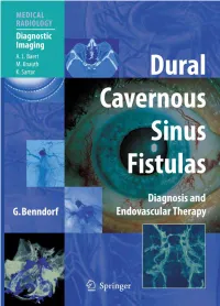 Classification of Cavernous Sinus Fistulas