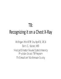 TB: Recognizing It on a Chest X-Ray