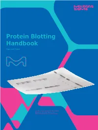 Protein Blotting Handbook Tips and Tricks