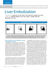 Liver Embolization MODERATORS: DAVID M
