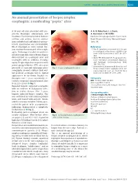 An Unusual Presentation of Herpes Simplex Esophagitis: a Nonhealing “Peptic” Ulcer
