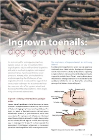 Ingrown Toenails: Digging out the Facts