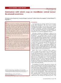 Gemination with Talon's Cusp on Mandibular Central Incisor