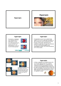 Hyperopia Hyperopia