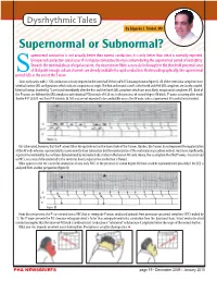Supernormal Or Subnormal? Upernormal Conduction Is Not Actually Better Than Normal Conduction; It Is Only Better Than What Is Normally Expected