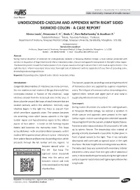UNDESCENDED CAECUM and APPENDIX with RIGHT SIDED SIGMOID COLON - a CASE REPORT Meera Jacob1 , Shivarama C