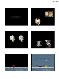 Durussel John -- Bone Mineralization Dependent Craniosynostosis and Craniofacial Shape Abnormalities.Pdf