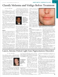 Lasers, Intense Pulsed Light Ease Pigmentation Disorders