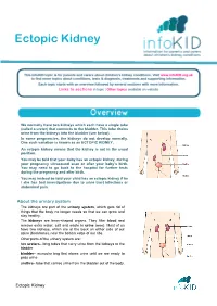Ectopic Kidney