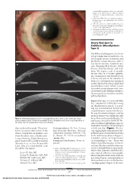 Mucolipidosis Type I)