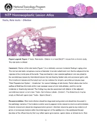 Testis, Rete Testis – Dilation