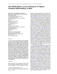 The Sept4 Septin Locus Is Required for Sperm Terminal Differentiation in Mice