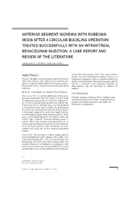 Anterior Segment Ischemia with Rubeosis Iridis After A