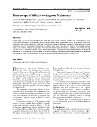 Dermoscopy of Difficult-To-Diagnose Melanomas