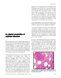 An Atypical Presentation of Erythema Induratum