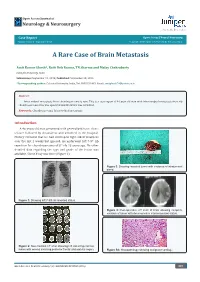A Rare Case of Brain Metastasis