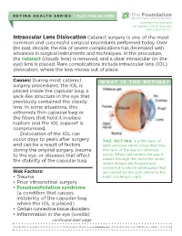 Intraocular Lens Dislocation Cataract Surgery Is One of the Most Common and Successful Surgical Pro­Cedures Performed Today