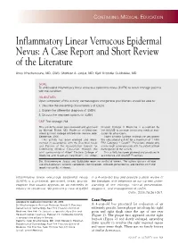 Inflammatory Linear Verrucous Epidermal Nevus: a Case Report and Short Review of the Literature