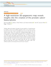 A High-Resolution 3D Epigenomic Map Reveals Insights Into the Creation of the Prostate Cancer Transcriptome