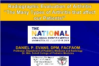 The Many Types of Arthritis That Affect Our Patients!”