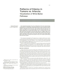 Patterns of Edema in Tumors Vs. Infarcts: Visualization of White Matter Pathways