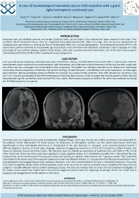 A Case of Frontotemporal Demen a Due to GRN Muta on with a Giant Right
