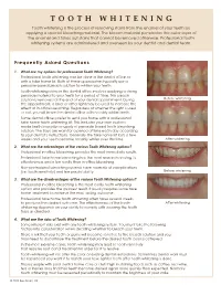TOOTH WHITENING Tooth Whitening Is the Process of Removing Stains from the Enamel of Your Teeth by Applying a Special Bleaching Material