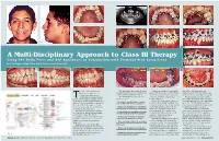 A Multi-Disciplinary Approach to Class III Therapy Using the Delta Force and ALF Appliances in Conjunction with Terminal Arch Extractions