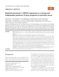 Expression Is a Strong and Independent Predictor of Poor Prognosis in Prostate Cancer