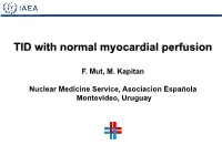 TID with Normal Myocardial Perfusion