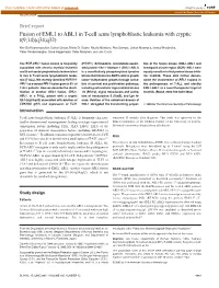 Fusion of EML1 to ABL1 in T-Cell Acute Lymphoblastic Leukemia with Cryptic T(9;14)(Q34;Q32)
